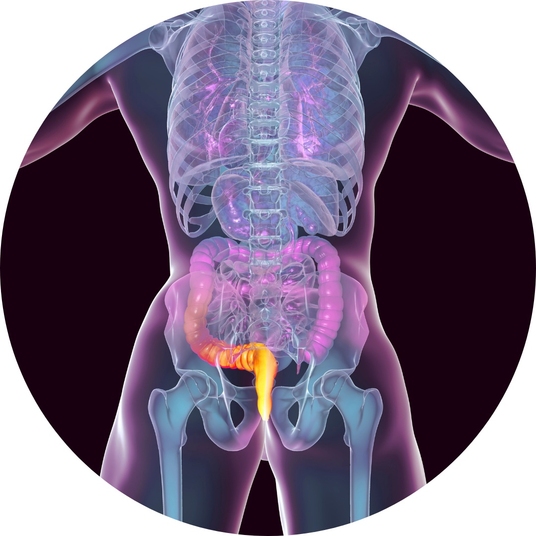 Haemorrhoid Treatment Wales | NHS Common Ailments